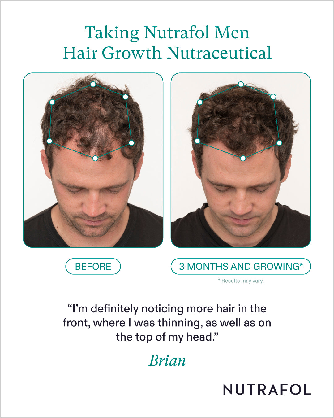 Nutrafol Hair Growth 100% Drug-Free Nutraceuticals for Men: 3-Month Supply | Exclusive Provider Pricing at VanityMD