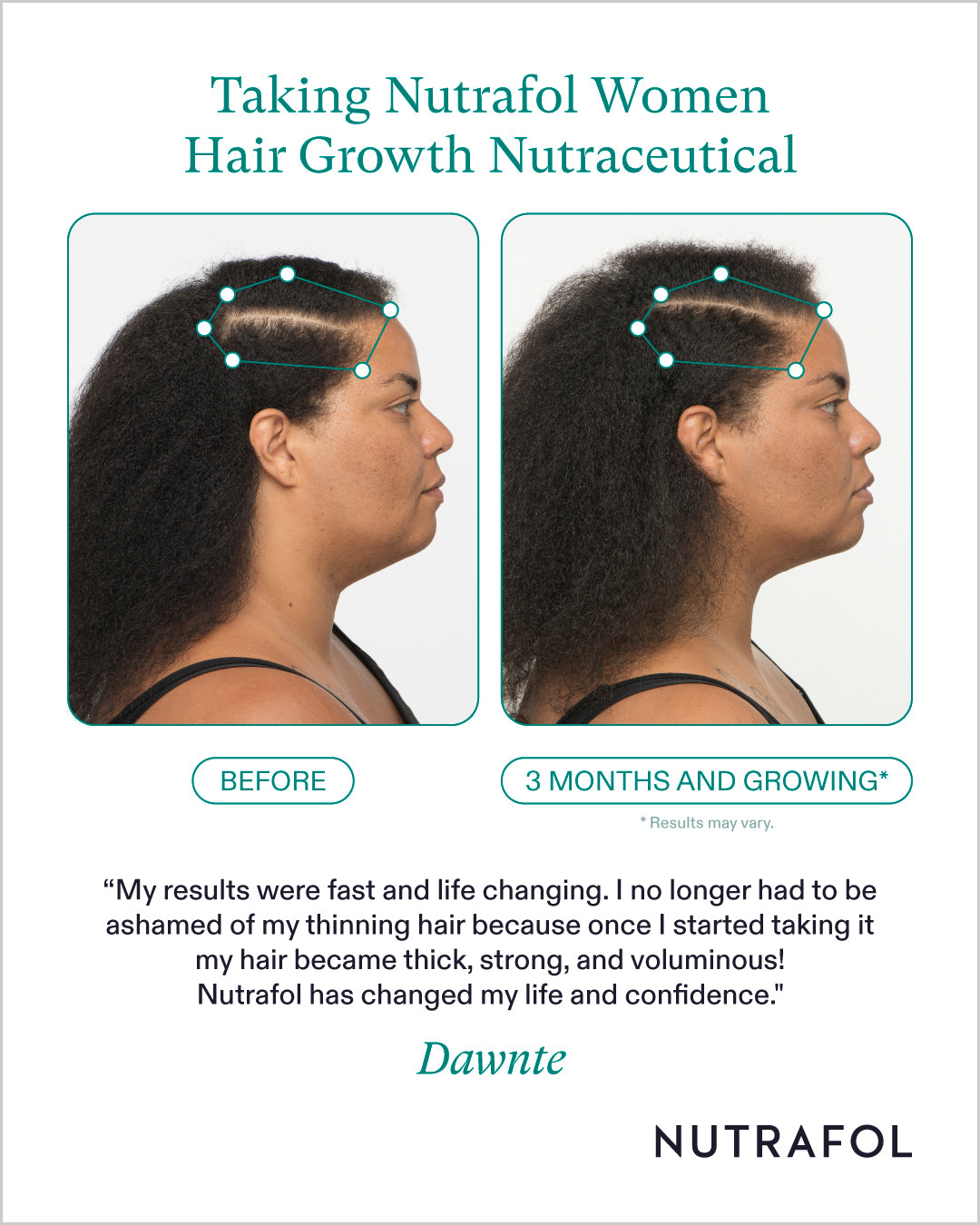 Nutrafol Hair Growth 100% Drug-Free Nutraceuticals for Women: 3-Month Supply | Exclusive Pricing at VanityMD