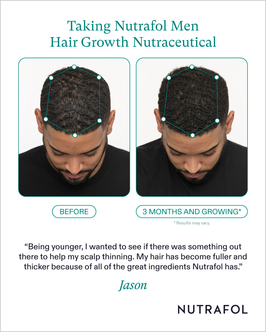 Nutrafol Hair Growth 100% Drug-Free Nutraceuticals for Men: 3-Month Supply | Exclusive Provider Pricing at VanityMD