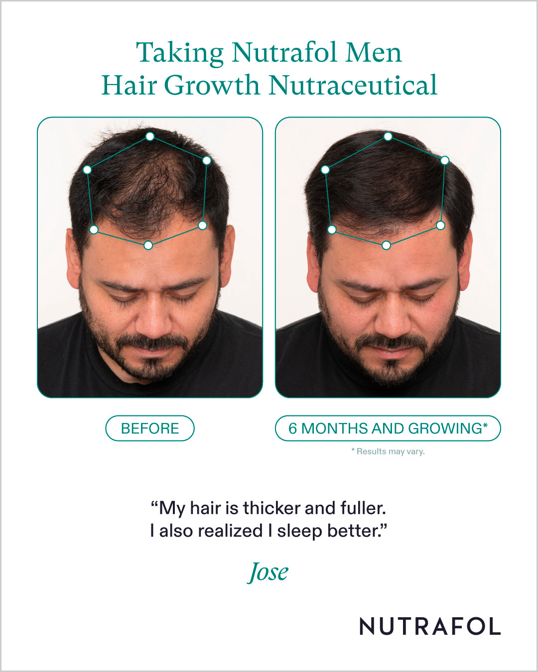 Nutrafol Hair Growth 100% Drug-Free Nutraceuticals for Men: 3-Month Supply | Exclusive Provider Pricing at VanityMD
