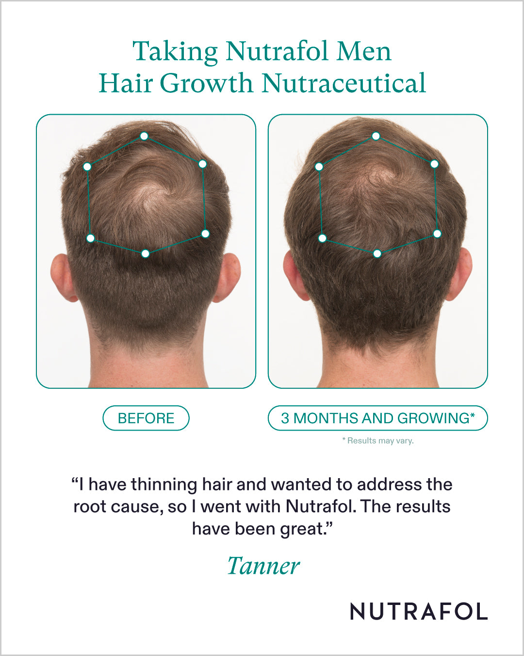Nutrafol Hair Growth 100% Drug-Free Nutraceuticals for Men: 3-Month Supply | Exclusive Provider Pricing at VanityMD