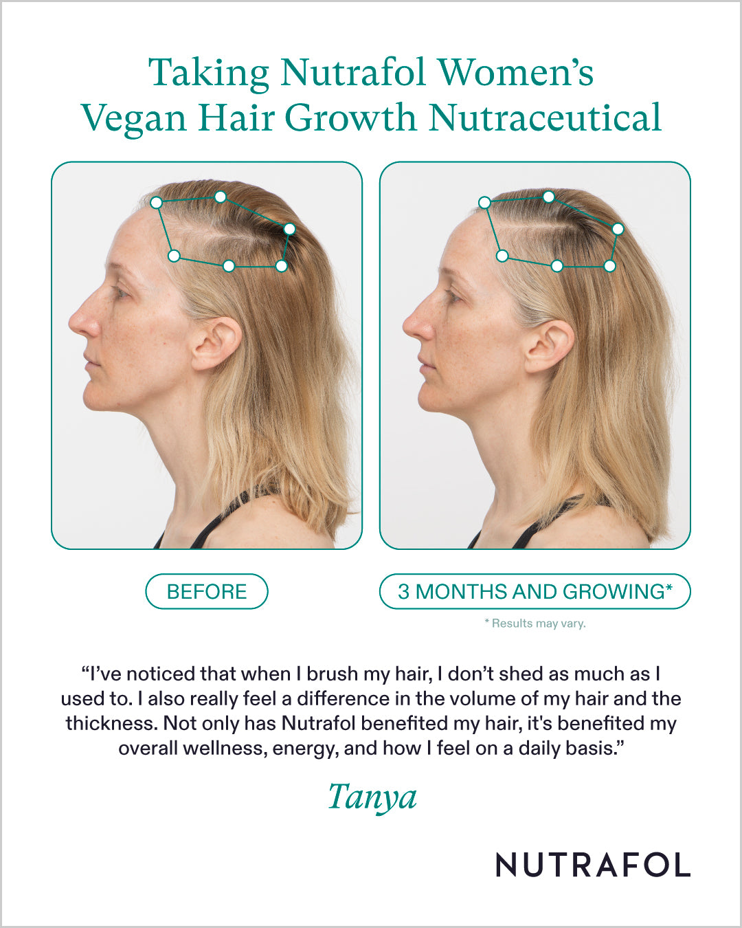 Nutrafol Hair Growth 100% Drug-Free Nutraceuticals for Women: 3-Month Supply | Exclusive Pricing at VanityMD