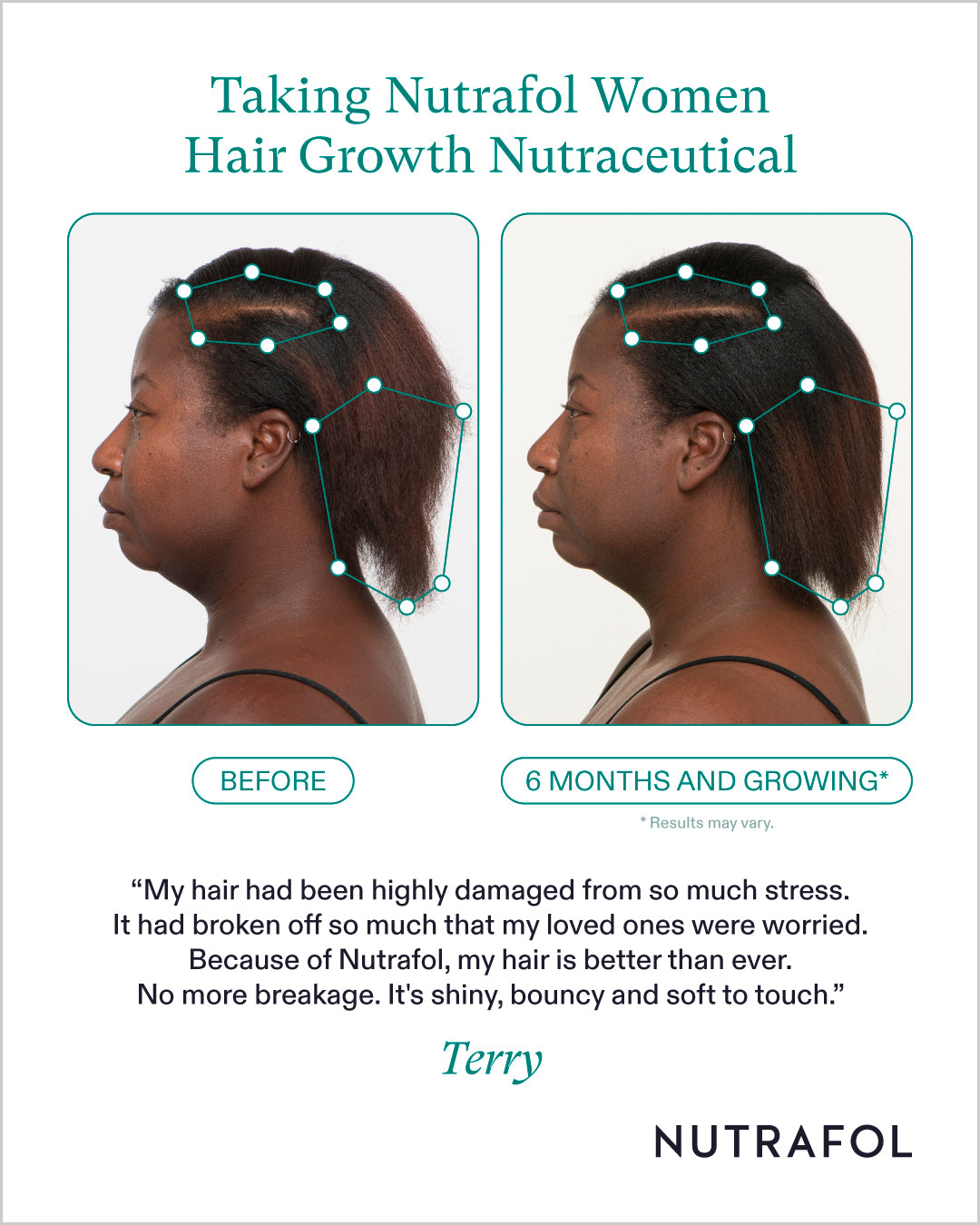 Nutrafol Hair Growth 100% Drug-Free Nutraceuticals for Women: 3-Month Supply | Exclusive Pricing at VanityMD