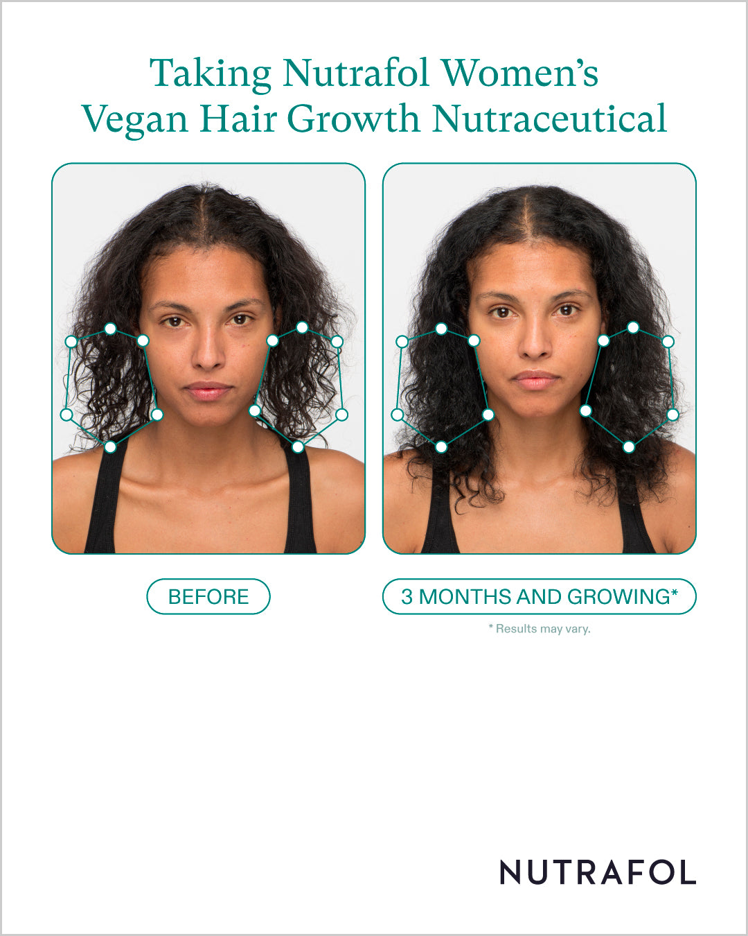 Nutrafol Hair Growth 100% Drug-Free Nutraceuticals for Women: 3-Month Supply | Exclusive Pricing at VanityMD